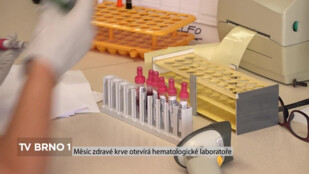 Měsíc zdravé krve otevírá hematologické laboratoře